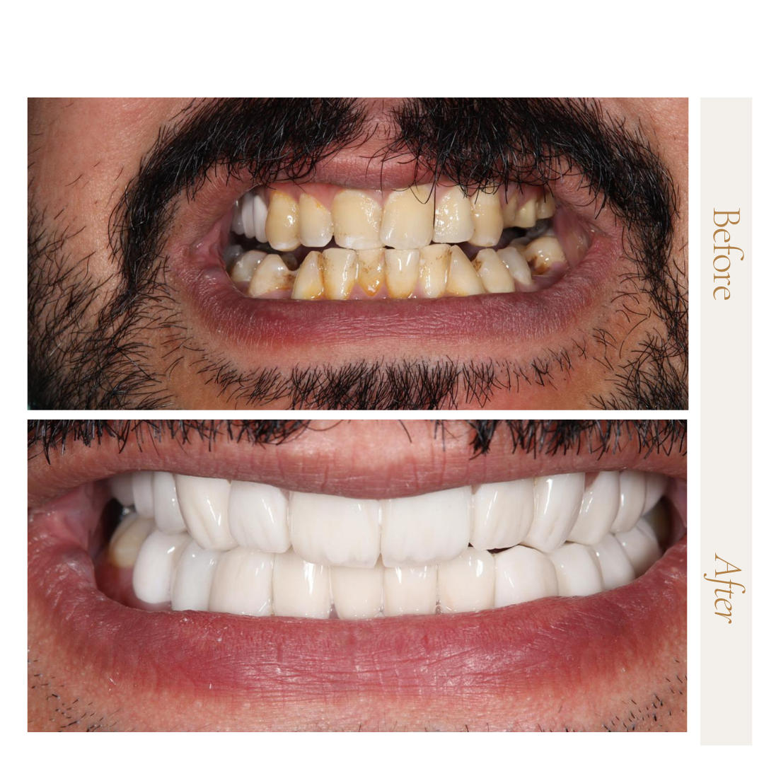 ابتسامه زاركون